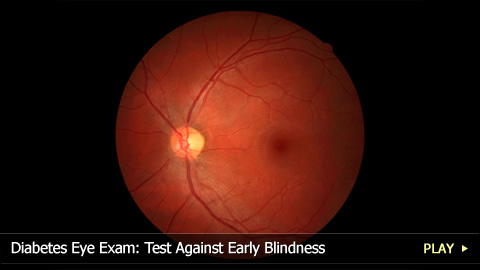 H Test Eye