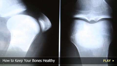 How To Keep Your Bones Healthy