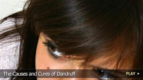 The Causes and Cures of Dandruff