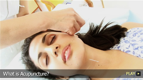 What is Acupuncture?  Part 1