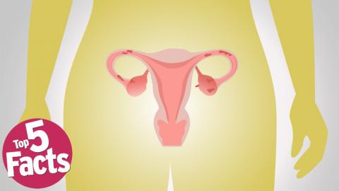 Top 5 Need to Know Facts about Endometriosis 