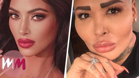 Top 10 Celebs Who Ruined Their Career With Plastic Surgery