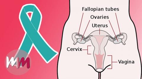Top 5 Cervical Cancer Facts You Should Know