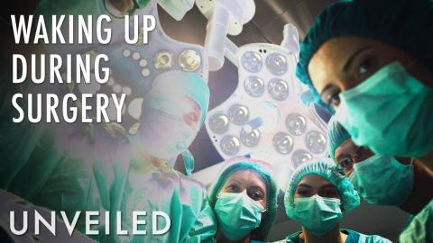 What If You Wake Up During Brain Surgery? | Unveiled