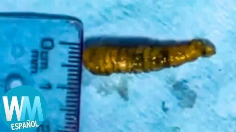 ¡Top 10  Cosas Más EXTRAÑAS que han Crecido en CUERPOS HUMANOS!