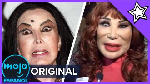 ¡Top 20 PEORES cirugías plásticas de Famosos LATINOS!