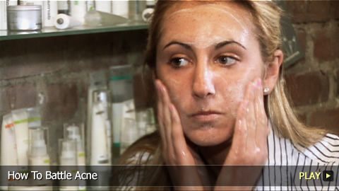 How To Battle Acne