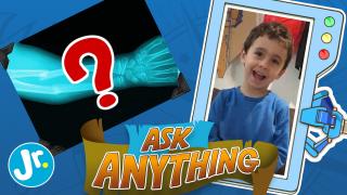 What Happens After I Break My Arm? - Ask Anything