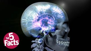 Top 5 Epilepsy Facts You Should Know