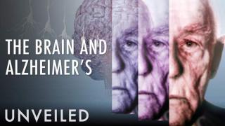 What Happens To The Brain During Alzheimer